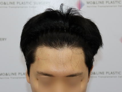 치료후기 이미지
